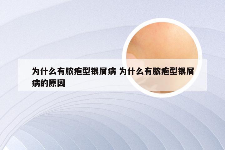 为什么有脓疱型银屑病 为什么有脓疱型银屑病的原因