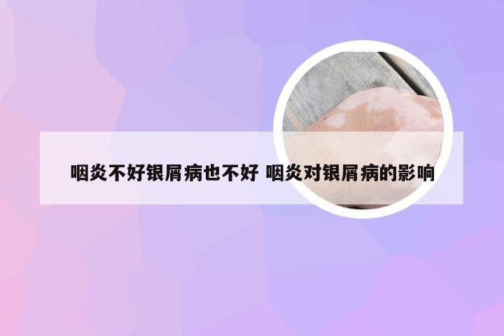 咽炎不好银屑病也不好 咽炎对银屑病的影响