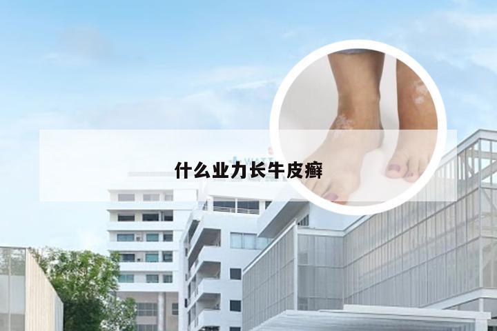 什么业力长牛皮癣