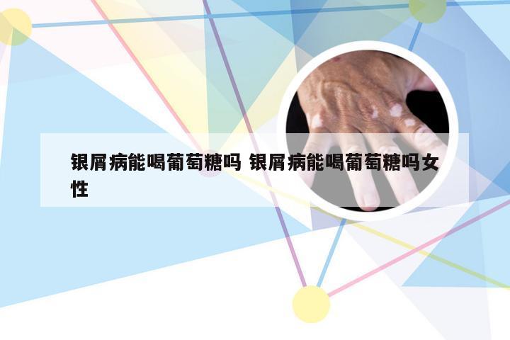 银屑病能喝葡萄糖吗 银屑病能喝葡萄糖吗女性