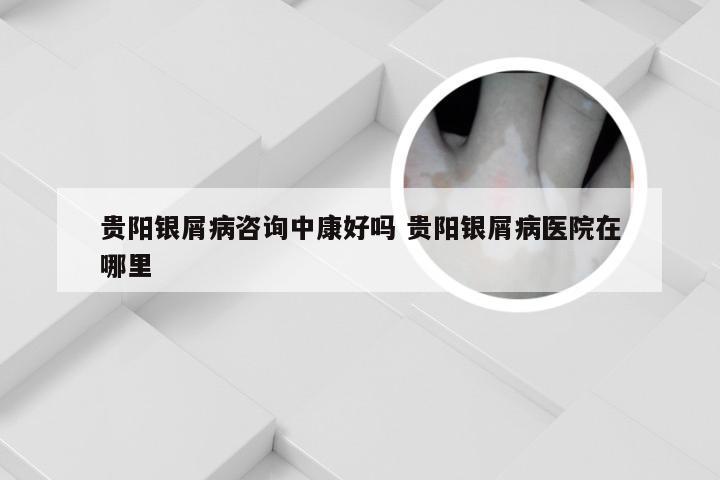 贵阳银屑病咨询中康好吗 贵阳银屑病医院在哪里
