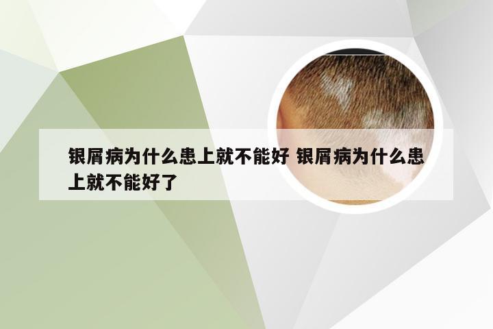银屑病为什么患上就不能好 银屑病为什么患上就不能好了