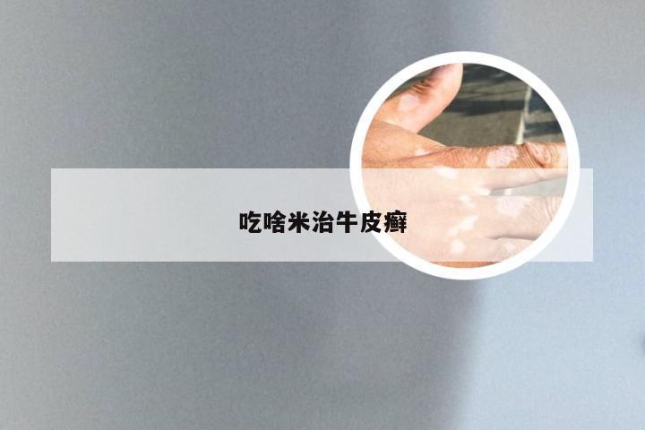 吃啥米治牛皮癣
