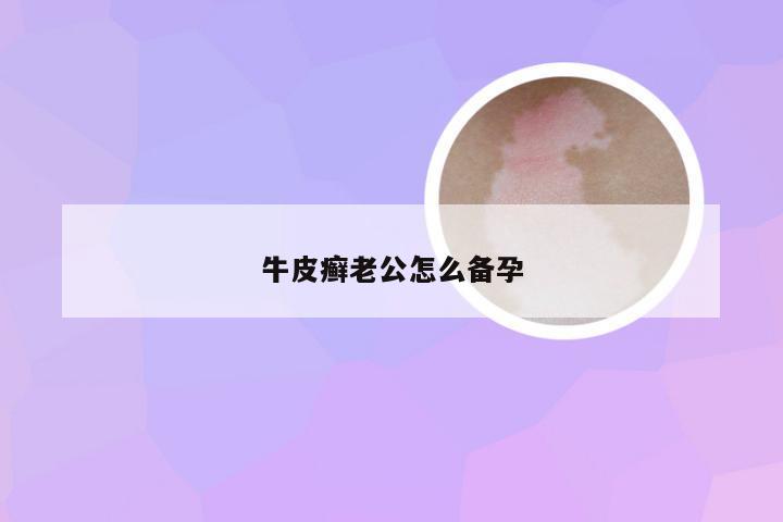 牛皮癣老公怎么备孕
