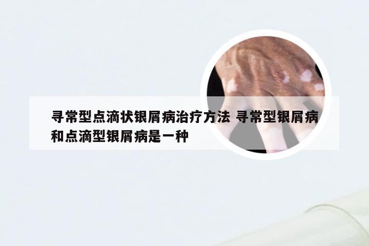 寻常型点滴状银屑病治疗方法 寻常型银屑病和点滴型银屑病是一种
