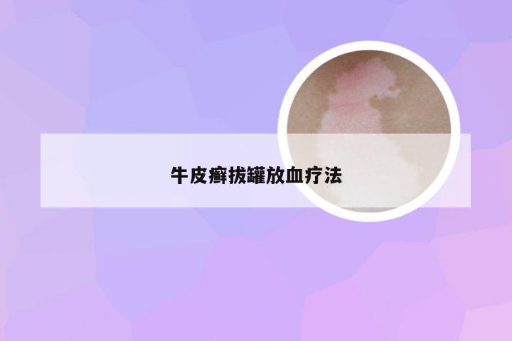 牛皮癣拔罐放血疗法