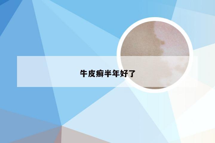 牛皮癣半年好了