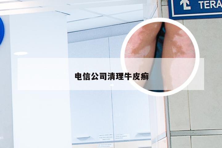 电信公司清理牛皮癣