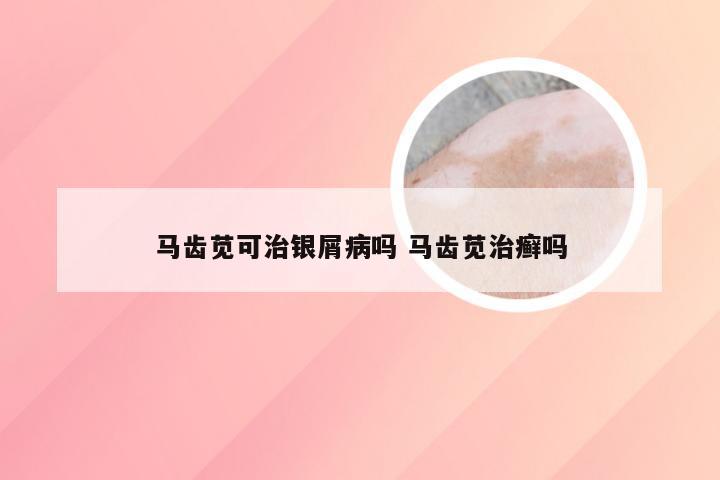 马齿苋可治银屑病吗 马齿苋治癣吗