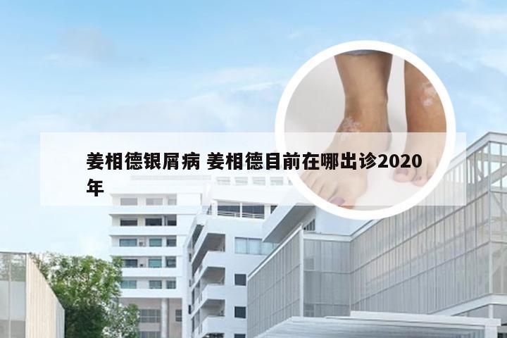 姜相德银屑病 姜相德目前在哪出诊2020年
