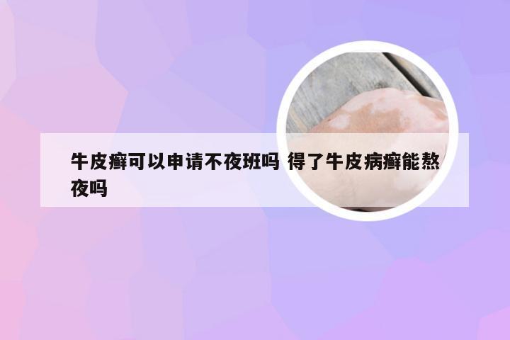 牛皮癣可以申请不夜班吗 得了牛皮病癣能熬夜吗