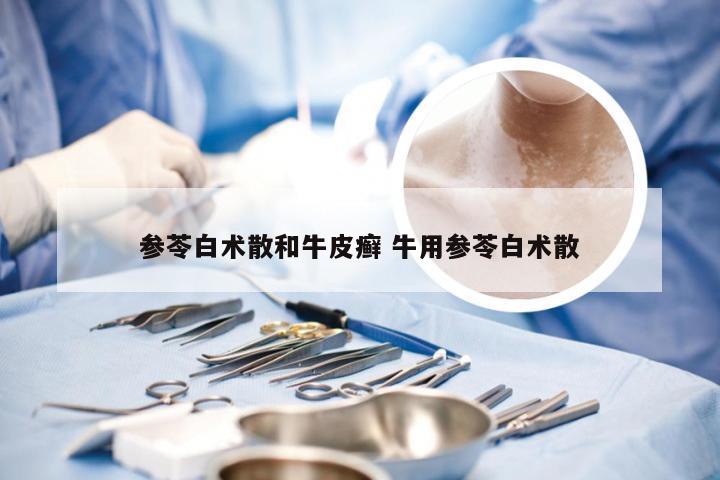 参苓白术散和牛皮癣 牛用参苓白术散