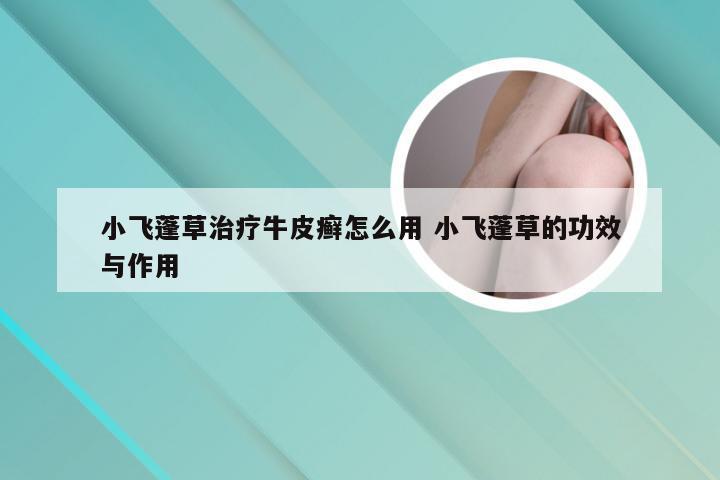 小飞蓬草治疗牛皮癣怎么用 小飞蓬草的功效与作用