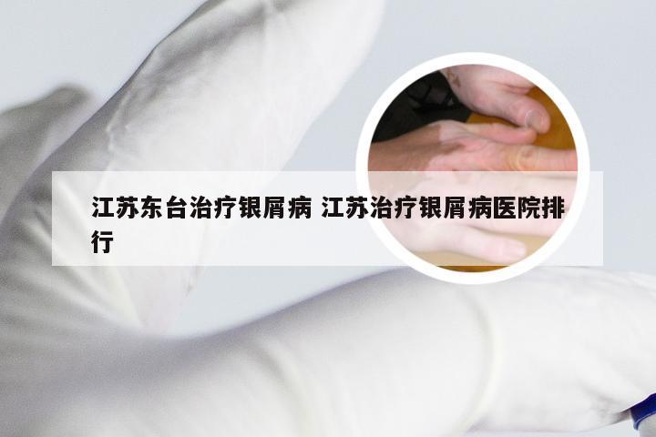 江苏东台治疗银屑病 江苏治疗银屑病医院排行