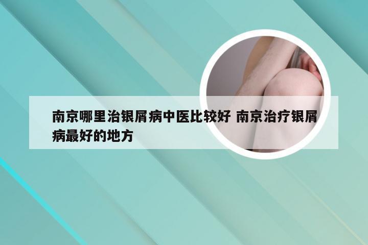 南京哪里治银屑病中医比较好 南京治疗银屑病最好的地方