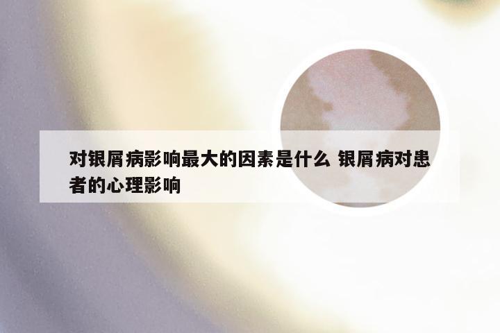 对银屑病影响最大的因素是什么 银屑病对患者的心理影响