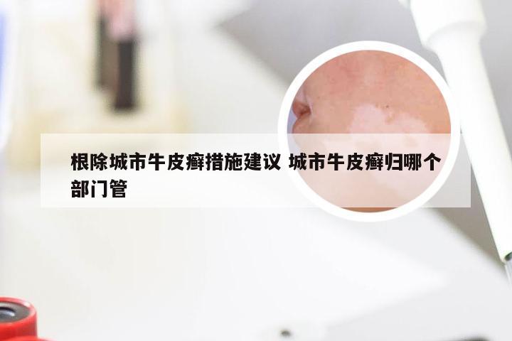 根除城市牛皮癣措施建议 城市牛皮癣归哪个部门管