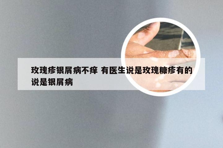 玫瑰疹银屑病不痒 有医生说是玫瑰糠疹有的说是银屑病