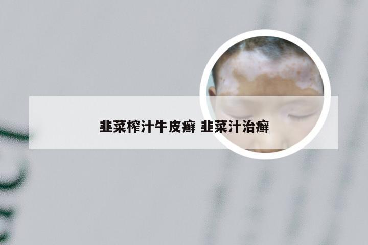 韭菜榨汁牛皮癣 韭菜汁治癣