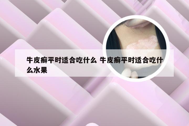 牛皮癣平时适合吃什么 牛皮癣平时适合吃什么水果