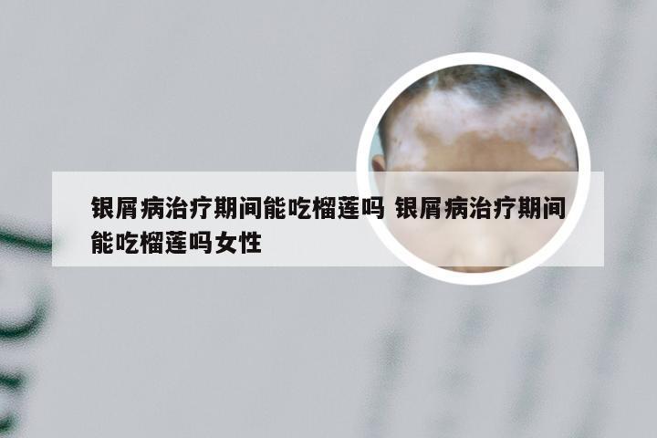 银屑病治疗期间能吃榴莲吗 银屑病治疗期间能吃榴莲吗女性