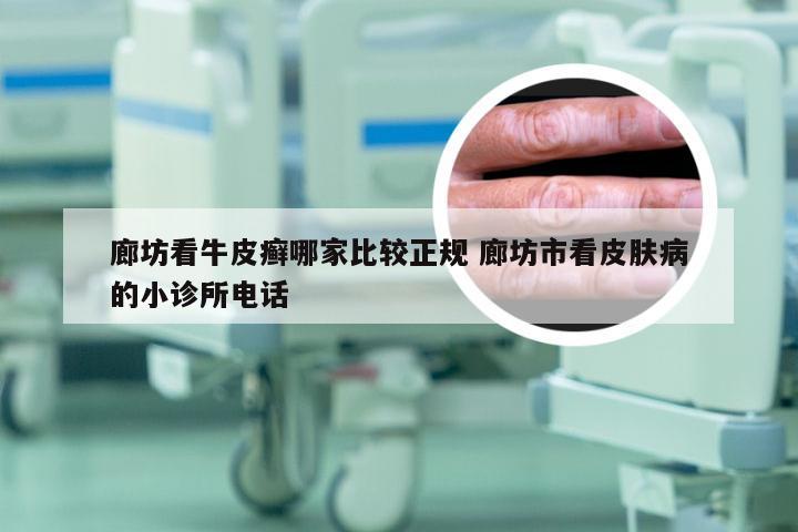 廊坊看牛皮癣哪家比较正规 廊坊市看皮肤病的小诊所电话