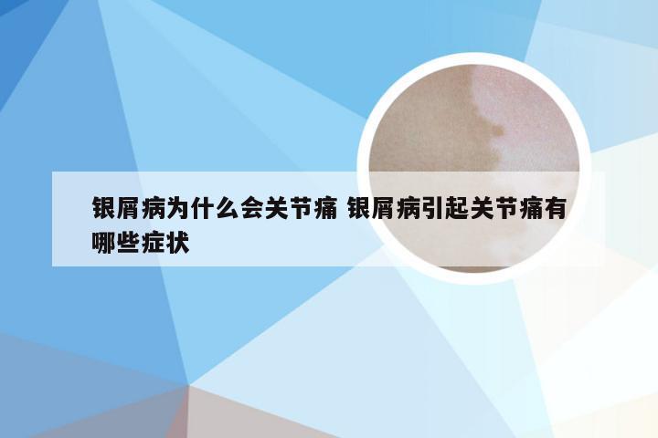 银屑病为什么会关节痛 银屑病引起关节痛有哪些症状