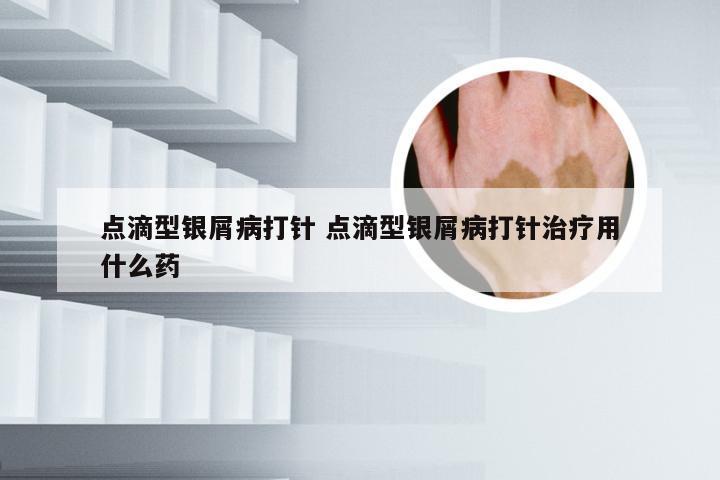 点滴型银屑病打针 点滴型银屑病打针治疗用什么药