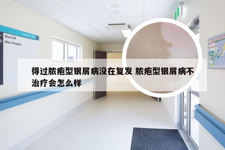得过脓疱型银屑病没在复发 脓疱型银屑病不治疗会怎么样