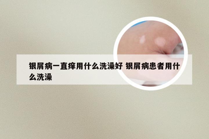 银屑病一直痒用什么洗澡好 银屑病患者用什么洗澡