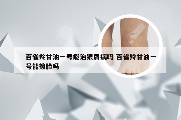 百雀羚甘油一号能治银屑病吗 百雀羚甘油一号能擦脸吗