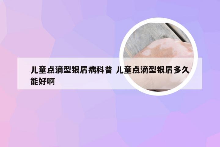 儿童点滴型银屑病科普 儿童点滴型银屑多久能好啊