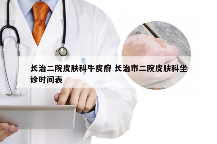 长治二院皮肤科牛皮癣 长治市二院皮肤科坐诊时间表