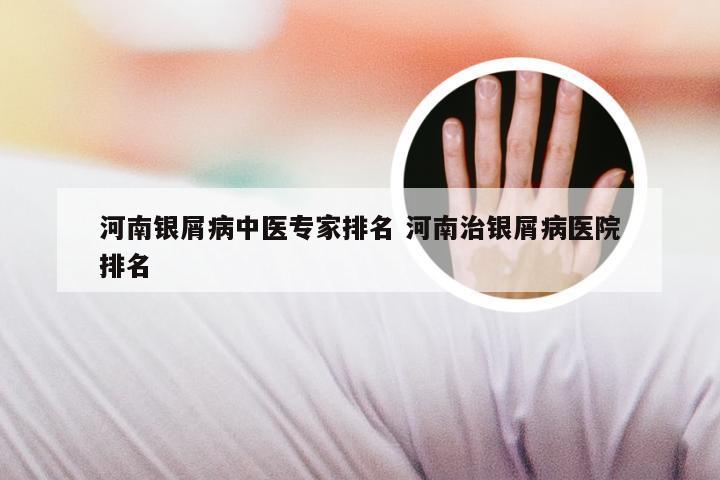 河南银屑病中医专家排名 河南治银屑病医院排名