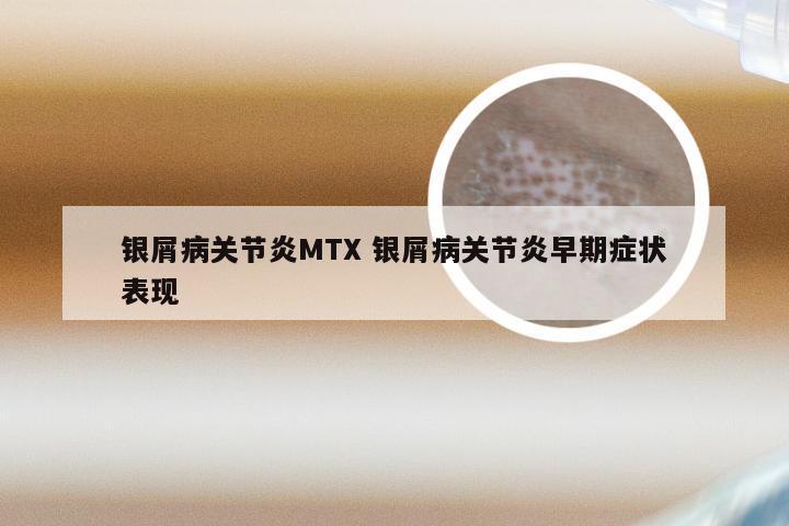 银屑病关节炎MTX 银屑病关节炎早期症状表现