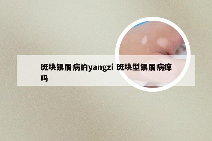 斑块银屑病的yangzi 斑块型银屑病痒吗