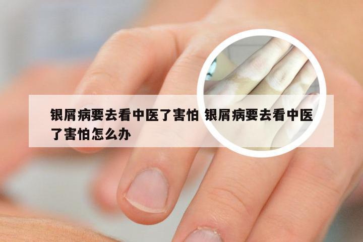 银屑病要去看中医了害怕 银屑病要去看中医了害怕怎么办