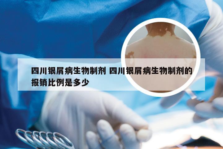 四川银屑病生物制剂 四川银屑病生物制剂的报销比例是多少