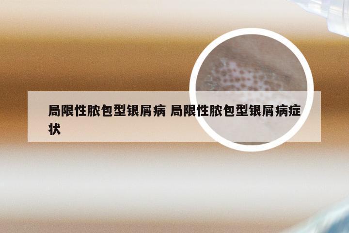 局限性脓包型银屑病 局限性脓包型银屑病症状