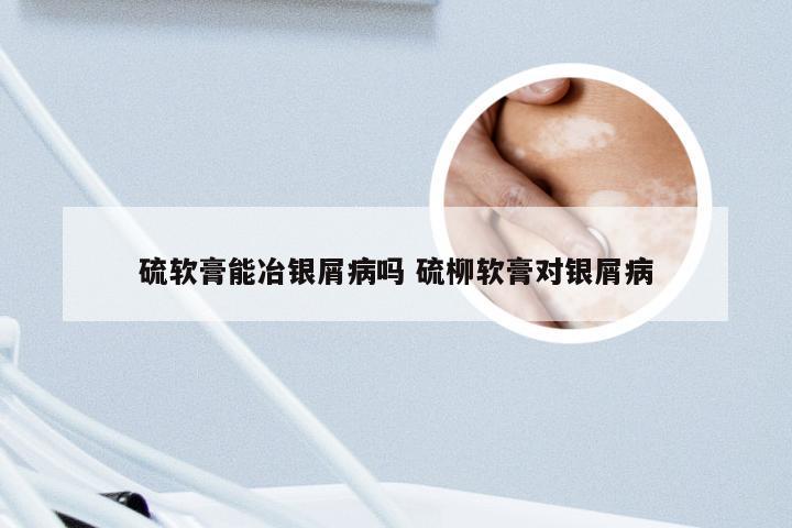 硫软膏能冶银屑病吗 硫柳软膏对银屑病
