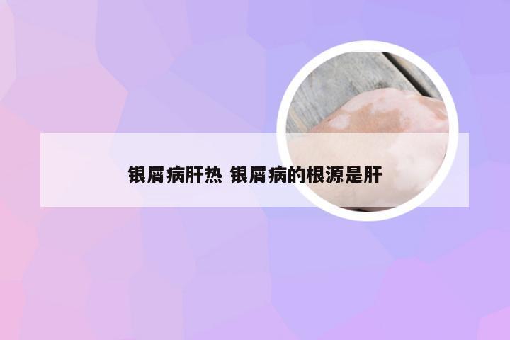 银屑病肝热 银屑病的根源是肝