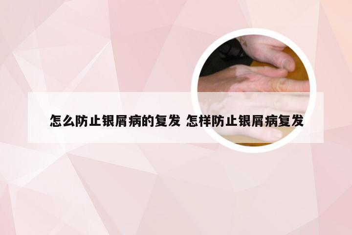 怎么防止银屑病的复发 怎样防止银屑病复发