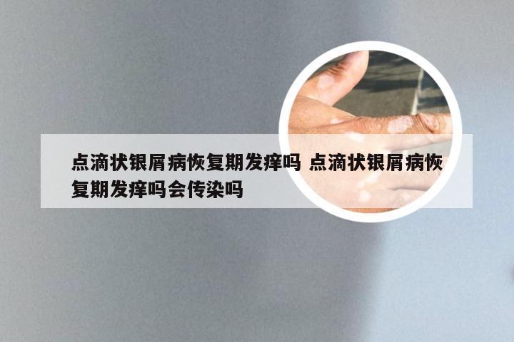点滴状银屑病恢复期发痒吗 点滴状银屑病恢复期发痒吗会传染吗