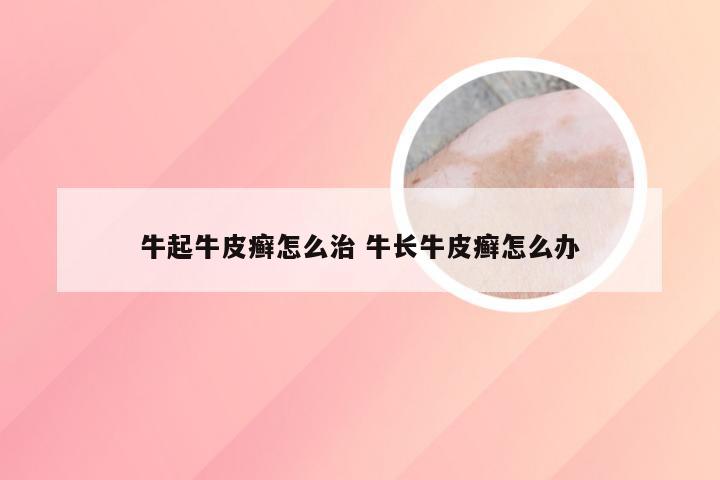牛起牛皮癣怎么治 牛长牛皮癣怎么办