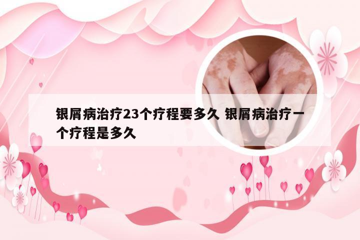 银屑病治疗23个疗程要多久 银屑病治疗一个疗程是多久