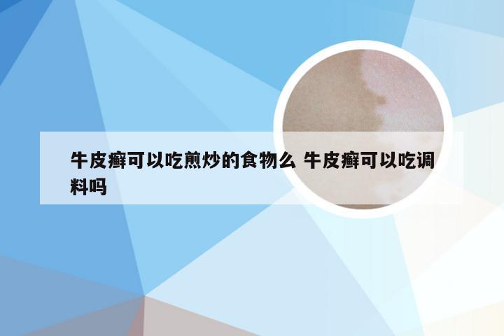 牛皮癣可以吃煎炒的食物么 牛皮癣可以吃调料吗