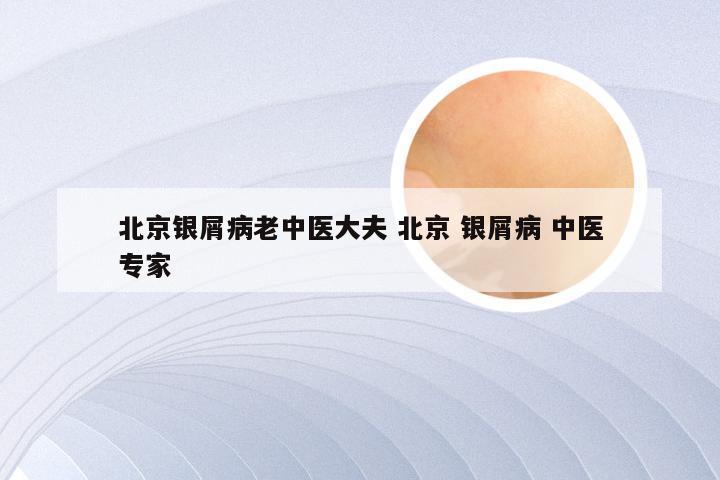 北京银屑病老中医大夫 北京 银屑病 中医专家