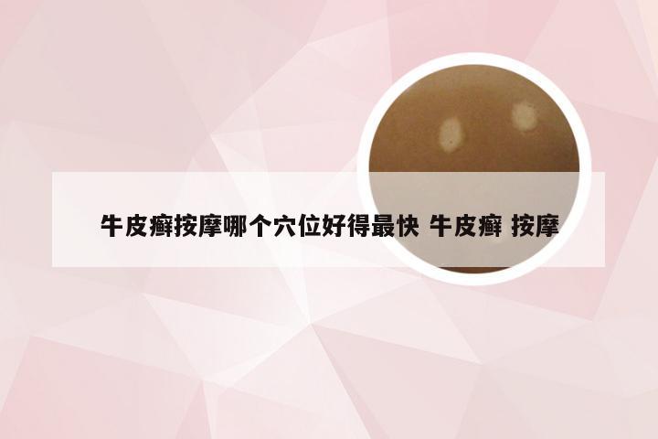 牛皮癣按摩哪个穴位好得最快 牛皮癣 按摩