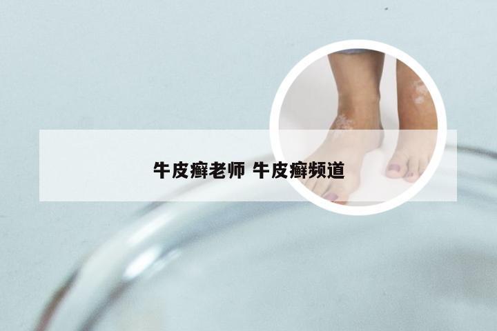 牛皮癣老师 牛皮癣频道