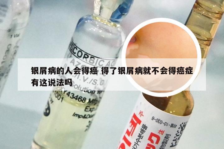 银屑病的人会得癌 得了银屑病就不会得癌症有这说法吗
